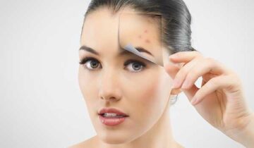How To Choose The Right Acne Skin Care Product